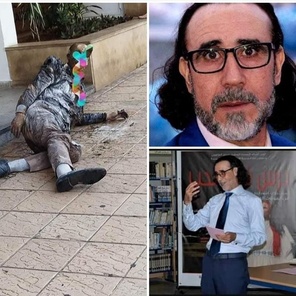 وفاة الفنان المسرحي أحمد جواد متأثرا بحروقه