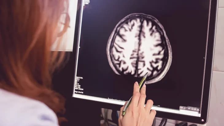 خبراء أميركيون يوصون بإجازة دواء من "إلاي ليلي" لمرض ألزهايمر