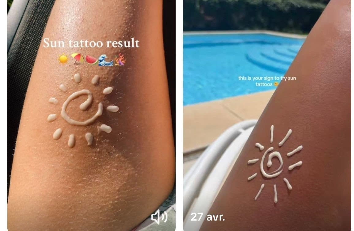 "Sun Tattoo".. موضة صيفية خطيرة تنتشر على تيك توك